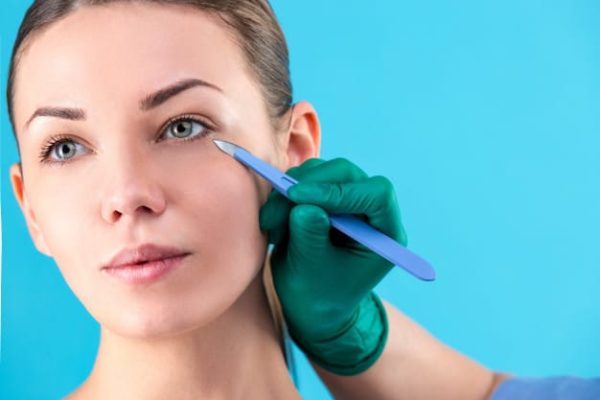 BLEFAROPLASTIA – CIRUGÍA DE PÁRPADOS
