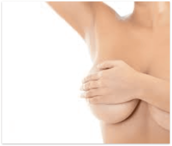 LABIOPLASTIA